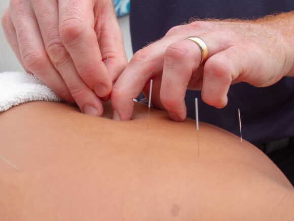 Practitioner Welcoming Patient for Acupuncture Treatment