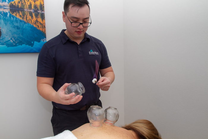 practitioner applying cupping therapy for back pain 