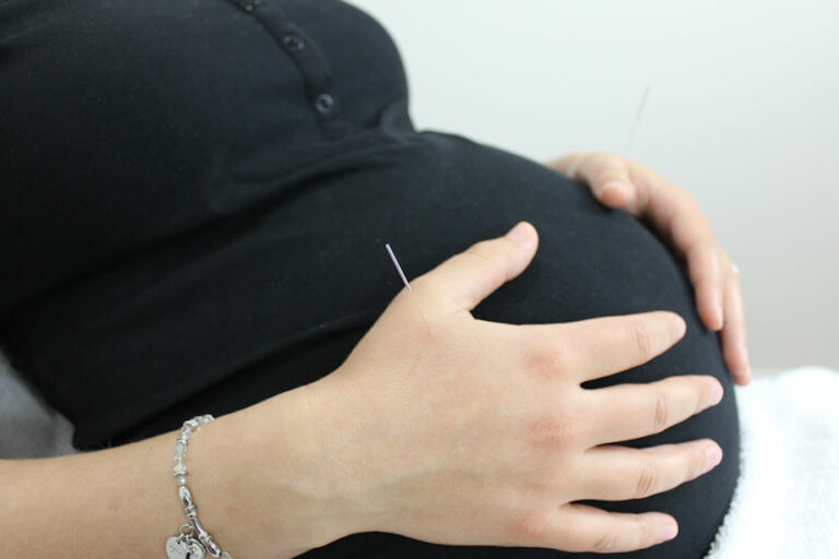Does Acupuncture Help Improve IVF Evolution Medical Care