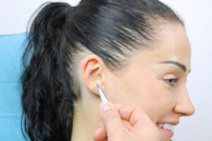 patient receiving auriculotherapy ear seeds for pain relief
