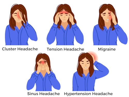 different types of headaches