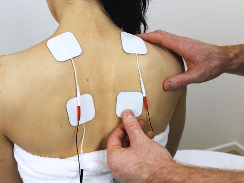 patient receiving tens therapy to disrupt the pain pathway for back pain and sciatica