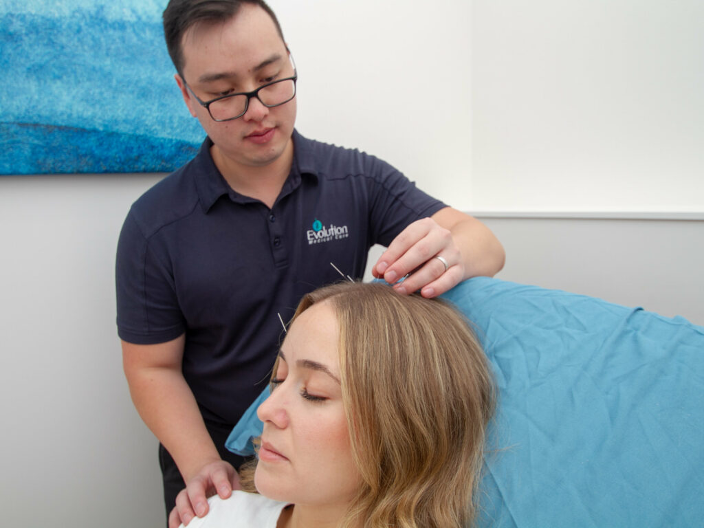 practitioner providing acupuncture treatment for a natural solution to releive migraine symptoms