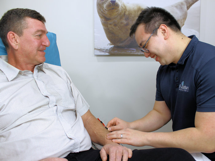 practitioner providing electro acupuncture treatment to enchance acupuncture benefits