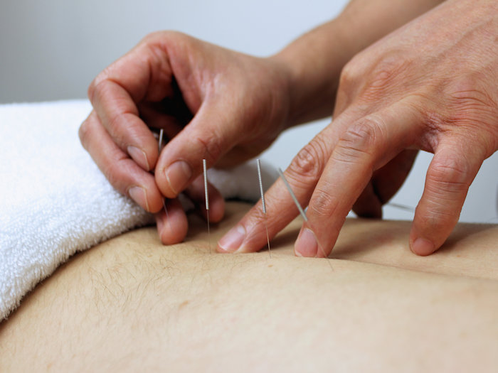acupuncture treatment to regulate hormones and assist with weight loss