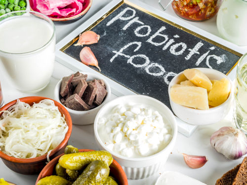 probiotic rich foods to support the gut brain axis and gut flora to support mental health