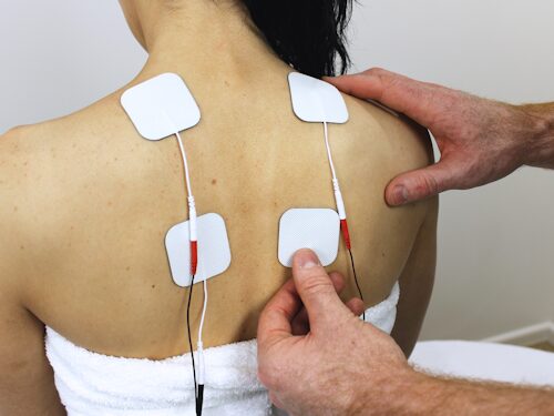 practitioner applying TENS therapy for pain relief