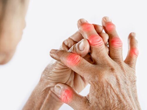 exacerbation of pain and arthritis symptoms during colder weather months