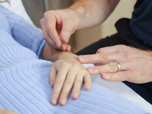 perosn having acupuncture treatment as a natural solution to promote healthy thyroid function