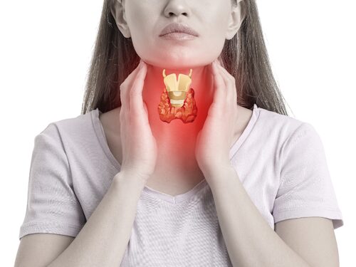 woman with thyroid issues