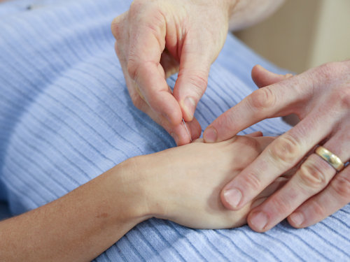 patient receiveing acupuncture treatment to help bells palsy causes and symptoms