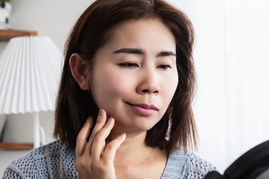 Woman with Bells Palsy drooping one side of face