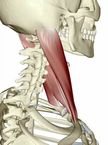 Sternocleidomastoid (SCM) Muscles associated with Neck Pain