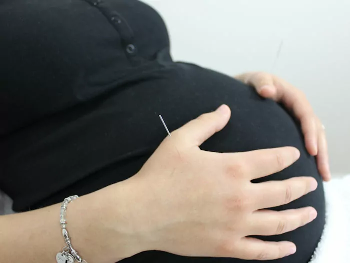 pregnant woman receiving acupuncture treatment to assist with labour induction