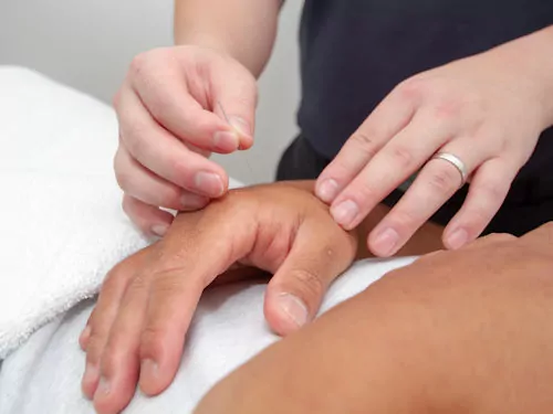 Patient dealing with insomnia receiving acupuncture treatment to help regulate sleep 